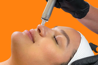 Laser Skin Revitilization at El Centro Dermatology